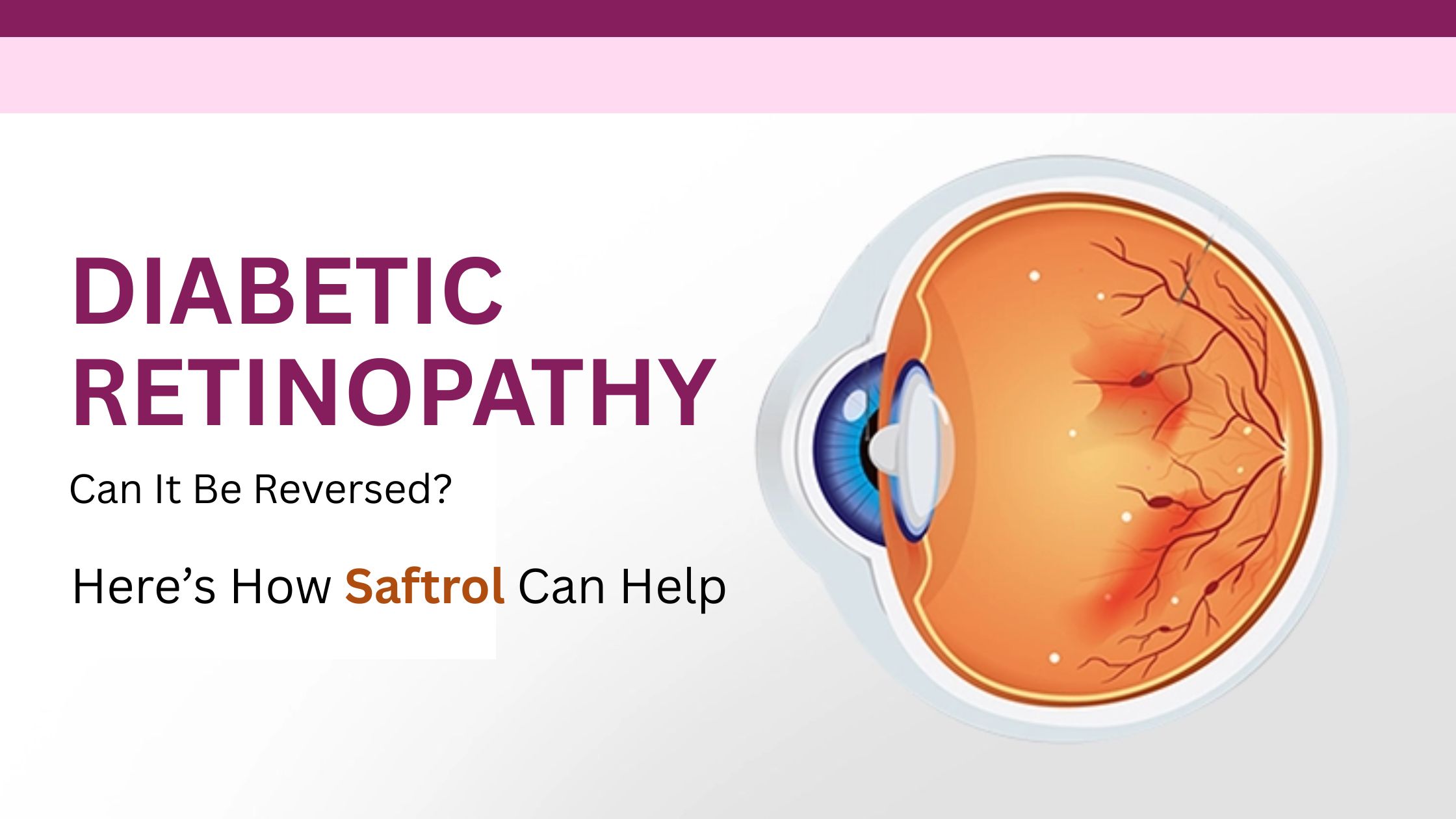 Diabetic Retinopathy: Can It Be Reversed? Here’s How Saftrol Can Help