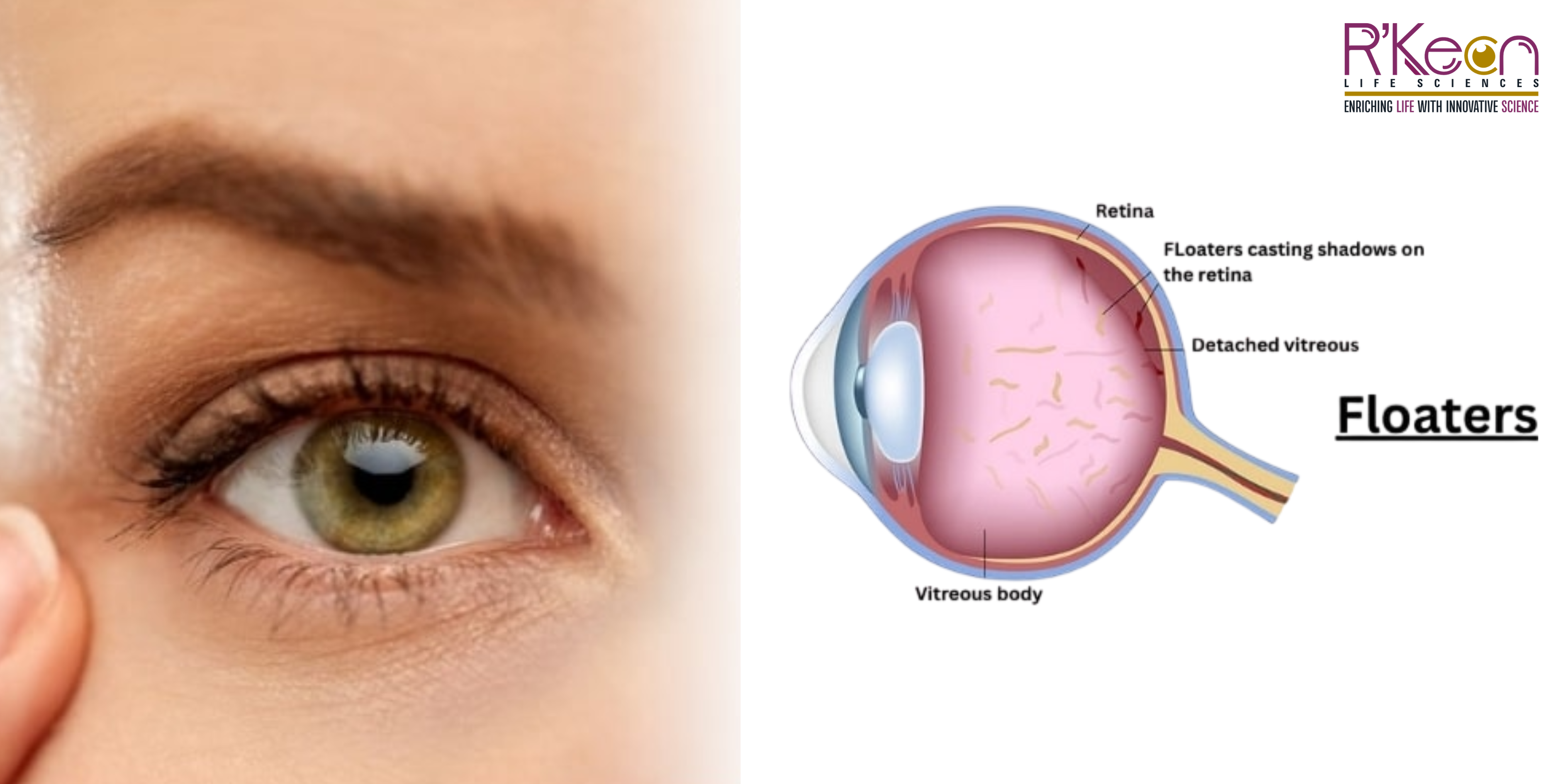 Floaterz Tablet: A Smarter Way to Support Eye Health from Within